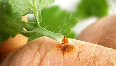 How to get to the wart with the binje