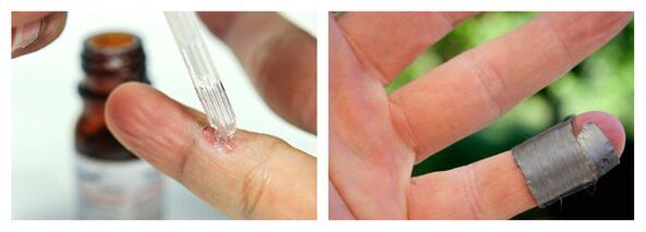 Chemical methods for healing nipples