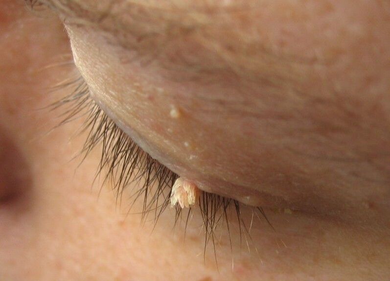 Nipples in front of our eyes