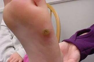 Nipples on their hands
