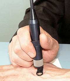 Papillom treatment